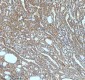 Anti-ASK1 MAP3K5 Rabbit Monoclonal Antibody