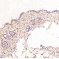 Anti-ASK1 MAP3K5 Rabbit Monoclonal Antibody