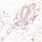 Anti-ASK1 MAP3K5 Rabbit Monoclonal Antibody