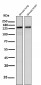 Anti-ASK1 MAP3K5 Rabbit Monoclonal Antibody