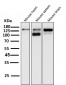 Anti-ASK1 MAP3K5 Rabbit Monoclonal Antibody