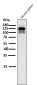 Anti-ASK1 MAP3K5 Rabbit Monoclonal Antibody