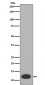 Anti-MRP8 S100A8 Rabbit Monoclonal Antibody