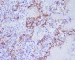 Anti-CD31 PECAM1 Rabbit Monoclonal Antibody