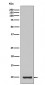 Anti-IGF1/Igf I Rabbit Monoclonal Antibody