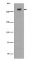 Anti-M6PR IGF2R Rabbit Monoclonal Antibody