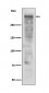 Anti-Ki67 MKI67 Rabbit Monoclonal Antibody