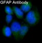 Anti-GFAP Rabbit Monoclonal Antibody