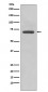 Anti-COX2 PTGS2 Rabbit Monoclonal Antibody