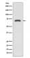 Anti-MMP8 Rabbit Monoclonal Antibody