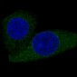 Anti-CPT2 Rabbit Monoclonal Antibody