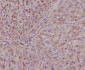 Anti-ASNS/Asparagine Synthetase Rabbit Monoclonal Antibody