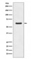 Anti-ASNS/Asparagine Synthetase Rabbit Monoclonal Antibody