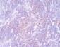 Anti-CD21 CR2 Rabbit Monoclonal Antibody