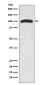 Anti-VAV2 Rabbit Monoclonal Antibody