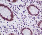 Anti-TOP1/Topoisomerase I Rabbit Monoclonal Antibody