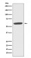 Anti-CYBB/Nox2 Rabbit Monoclonal Antibody