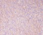 Anti-PKM2 Rabbit Monoclonal Antibody