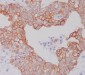 Anti-ATG5/Apg5 Rabbit Monoclonal Antibody
