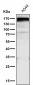 Anti-Gli1 Rabbit Monoclonal Antibody