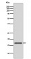 Anti-AGR2/Ag 2 Rabbit Monoclonal Antibody