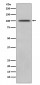 Anti-CD10 MME Rabbit Monoclonal Antibody