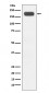 Anti-BRG1 Rabbit Monoclonal Antibody