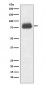 Anti-CD36/Sr B3 Rabbit Monoclonal Antibody