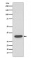 Anti-CDK4 Rabbit Monoclonal Antibody