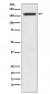 Anti-IRS1 Rabbit Monoclonal Antibody