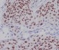 Anti-CDK9 Rabbit Monoclonal Antibody