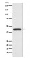 Anti-CDK9 Rabbit Monoclonal Antibody