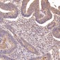 Anti-PTEN Rabbit Monoclonal Antibody