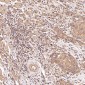 Anti-PTEN Rabbit Monoclonal Antibody