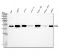 Anti-SOD2/Mnsod Rabbit Monoclonal Antibody