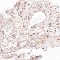 Anti-LC3B MAP1LC3B Rabbit Monoclonal Antibody