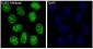 Anti-E2F1 Rabbit Monoclonal Antibody