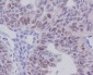 Anti-E2F1 Rabbit Monoclonal Antibody