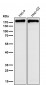 Anti-FASN/Fatty Acid Synthase Rabbit Monoclonal Antibody
