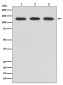 Anti-ABL2 Rabbit Monoclonal Antibody