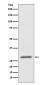 Anti-CD99 Rabbit Monoclonal Antibody