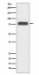 Anti-TBR1 Rabbit Monoclonal Antibody