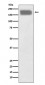 Anti-NCAM NCAM1 Rabbit Monoclonal Antibody