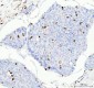 Anti-CD74 Rabbit Monoclonal Antibody