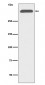 Anti-ApoB/Apolipoprotein B Rabbit Monoclonal Antibody