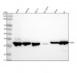 Anti-NQO1/Dt Diaphorase Rabbit Monoclonal Antibody