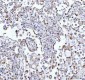 Anti-ATPB Rabbit Monoclonal Antibody