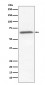 Anti-Ku70 XRCC6 Rabbit Monoclonal Antibody