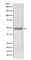 Anti-ADFP PLIN2 Rabbit Monoclonal Antibody