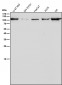 Anti-CD26/DPP4 Rabbit Monoclonal Antibody